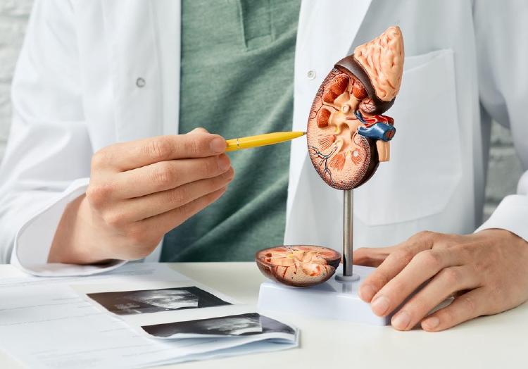 médico con una maqueta de una glándula suprarrenal