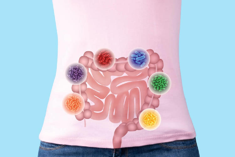 dibujo representando la microbiota intestinal alterada
